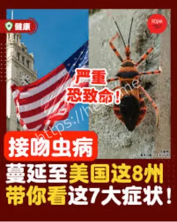 接吻虫病查加斯