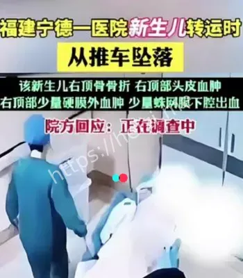 新生儿坠落骨折